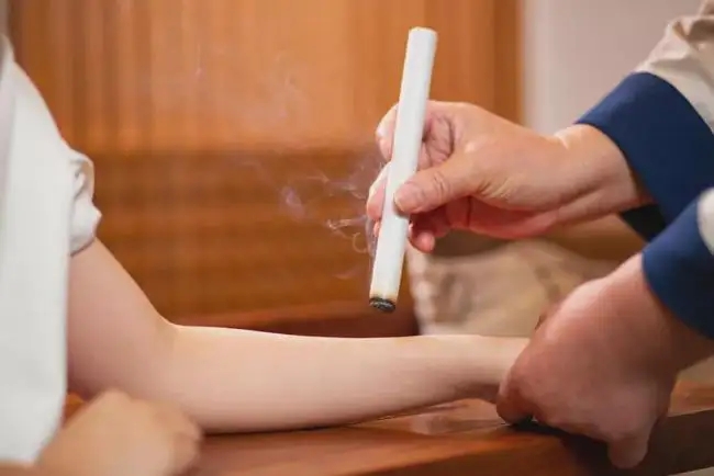艾灸和拔罐的注意事項！